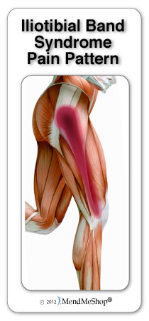 Sparcc - Iliotibial band (IT Band) Syndrome is a common cause of